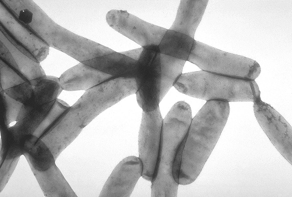 Transmission electron microscopy image of Legionella pneumophila, responsible for over 90% of Legionnaires' disease cases. Photo: CDC Public Health Image Library, Wikimedia, Public Domain