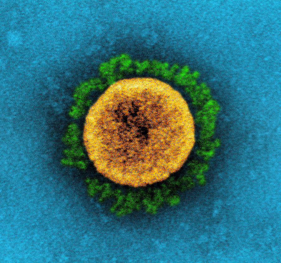 The UK variant of the coronavirus. Photo by NIAID, CC BY 2.0