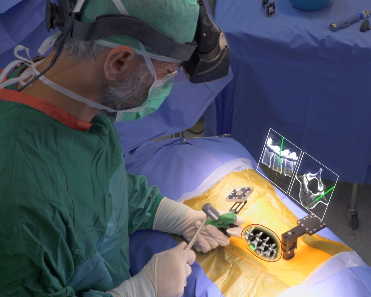 Augmedics Raises 36M To Continue AR Surgical Guidance Efforts